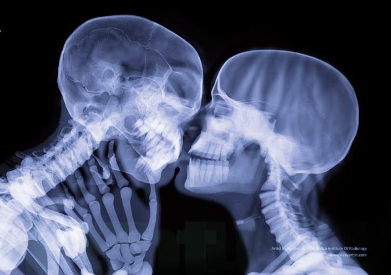 10 звичних речей з нашого життя під рентгеном (ФОТО)