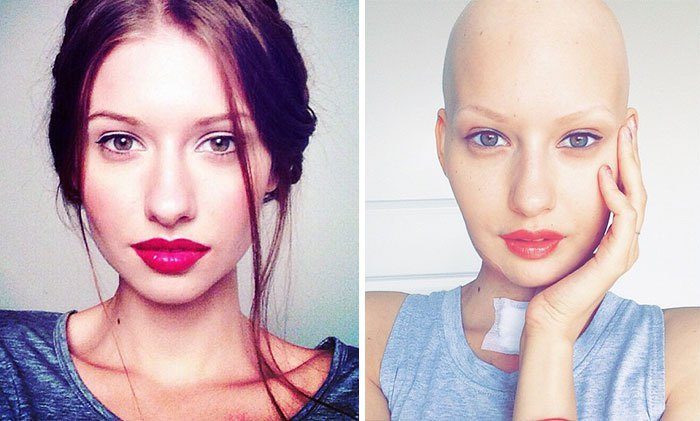 Після важкої боротьби з раком, 24-річна модель повернулася до роботи і народила здорову дитину