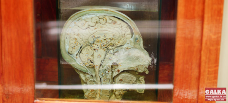 Поєднання людських органів та естетики – у Франківську відкрили найкращий анатомічний музей в Україні (ФОТО)