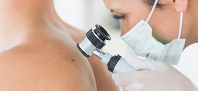 Новий метод визначення злоякісних утворень шкіри – дерматоскопія вже в Івано-Франківську