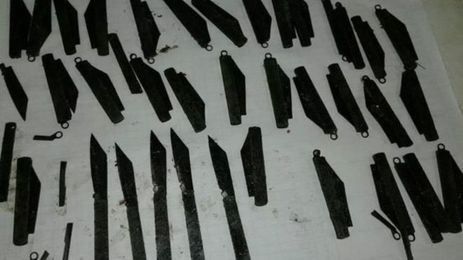 Зі шлунка індійця лікарі витягнули сорок ножів