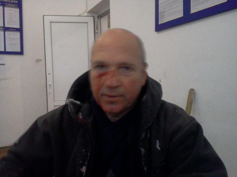 Франківського активіста побили льодорубом