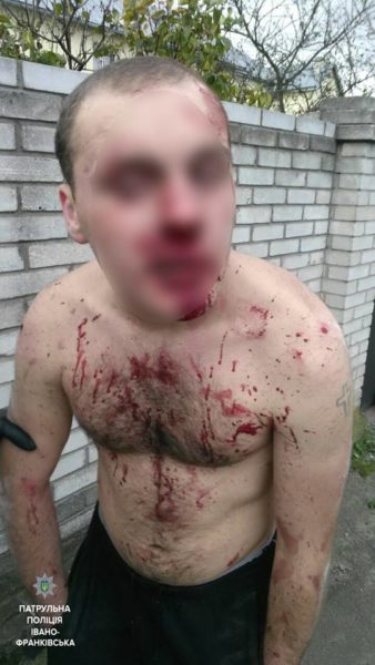 У Франківську четверо молодиків жорстоко побили хлопця (ФОТО)