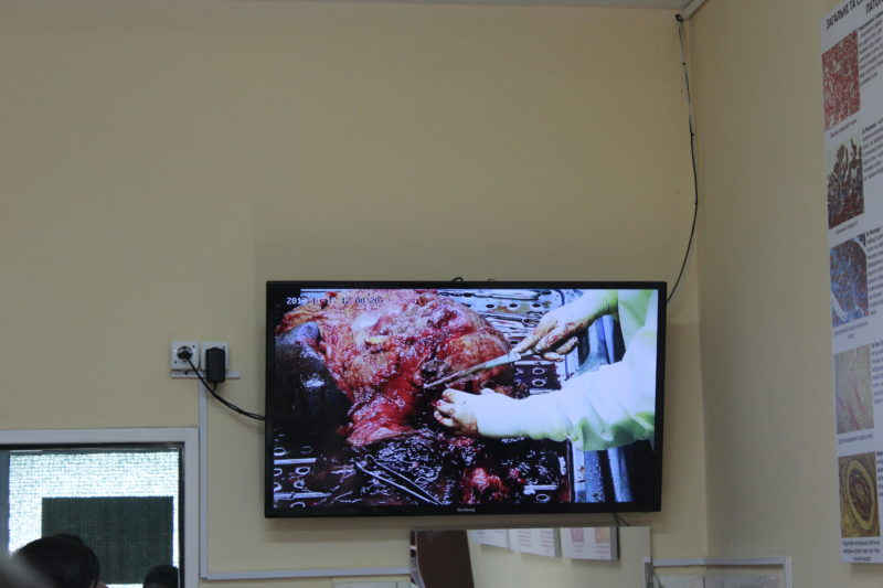Франківські студенти-медики зможуть спостерігати за розтинами у режимі онлайн (ФОТО)