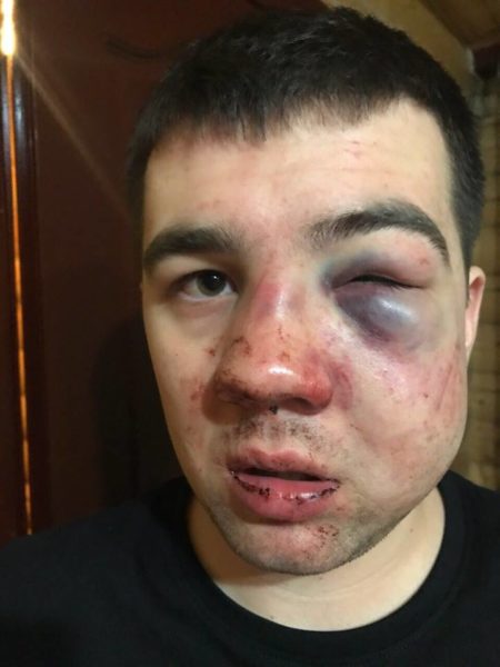 У Буковелі охоронці нічного клубу жорстоко побили сина депутата (ФОТО)