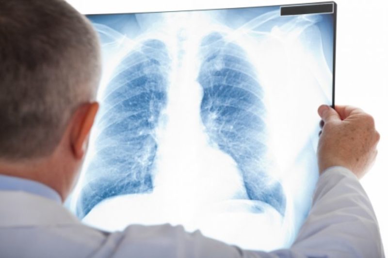 На Яремчанщині захворюваність на туберкульоз зросла вдвічі